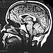 neuroanatomist's Avatar neuroanatomist's Avatar